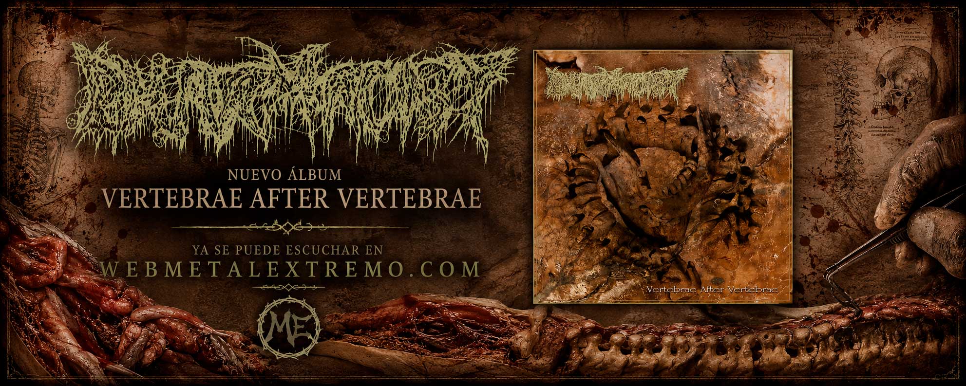 Pharmacist vuelve con “Vertebrae After Vertebrae”: pura locura deathgrind